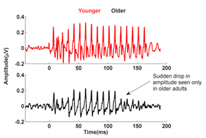 Comparison of brain activity relating to sounds in young and old humans.